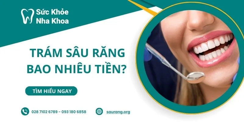 trám sâu răng bao nhiêu tiền